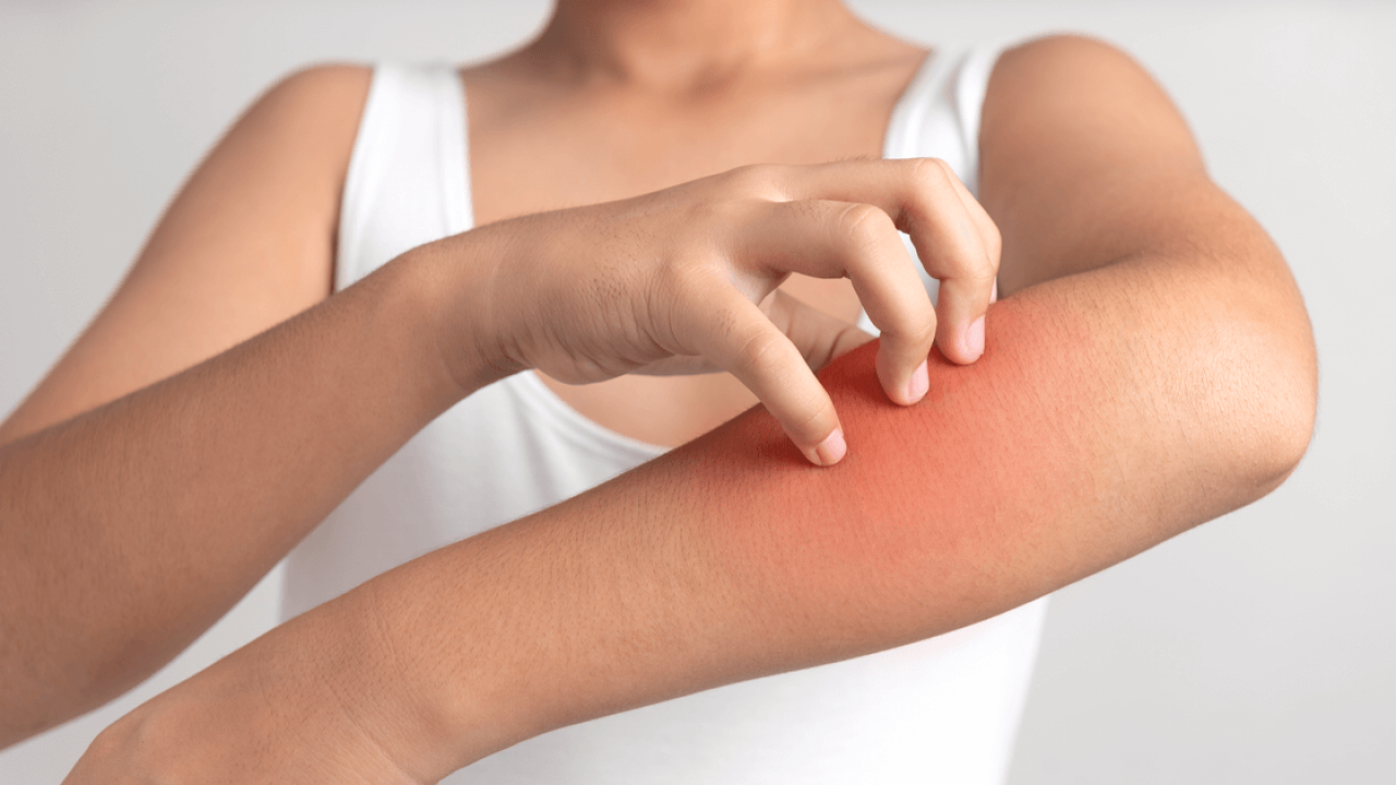 Histamine Intolerance: DAO Enzyme (Diamine Oxidase) is Key